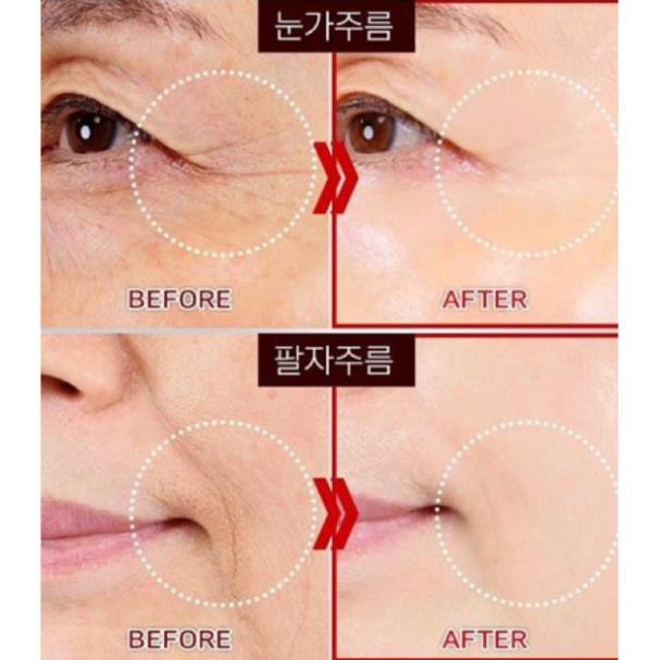 Tách set 4ml date 2026 - Kem trẻ hoá vùng mắt Whoo Hoàn Lưu Cao