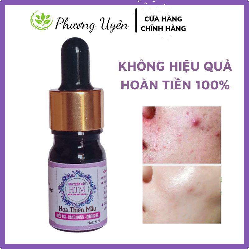 Serum Mụn Hoa Thiên Mẫu - Hiệu Quả Sau 24h