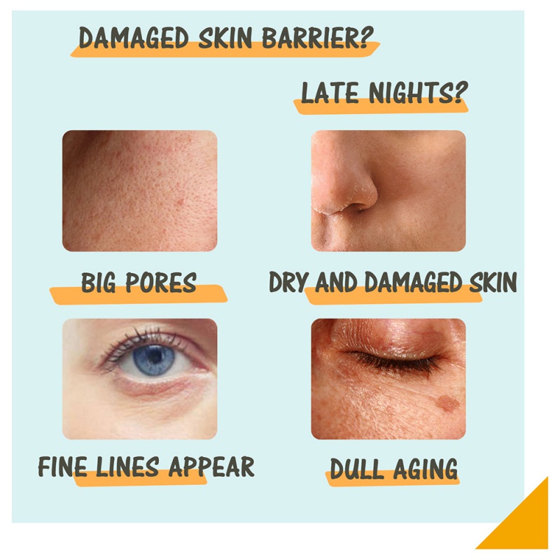 Tinh Chất Vitamin C Retinol Làm Sáng Da Chống Nếp Nhăn Lão Hóa Dưỡng Ẩm Làm Săn Chắc Làn Da Dùng Ngày Và Đêm