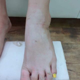 Lột colagen ND white