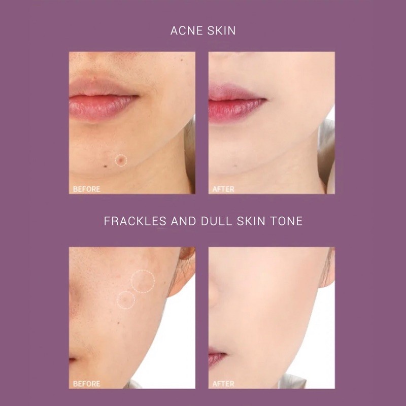 AMORTALS Bảng Che Khuyết Điểm Ba Màu Kem Che Khuyết Điểm Hàng Chính Hãng Có Mã Bảo Mật Kem Che Khuyết Điểm Vết Mụn Quầng thâm Đốm Phấn mụn trứng cá