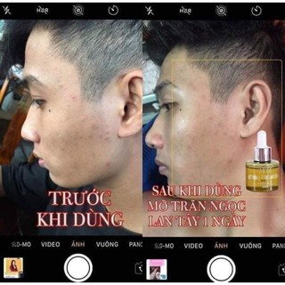 Mỡ trăn ngọc lan tây Nstore