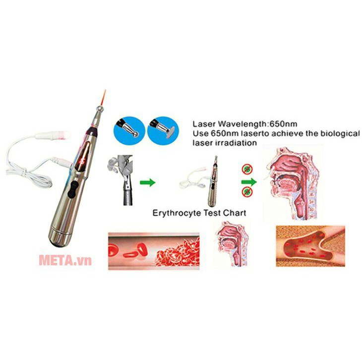 Bút Dò Huyệt Châm Cứu Điều Trị Viêm Xoang AUKEWEL DR LASER AK-2000C