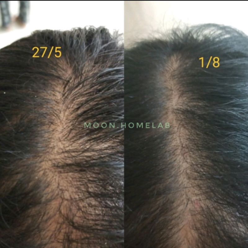 XỊT DƯỠNG KÍCH MỌC TÓC BƯỞI VÀ BIOTIN