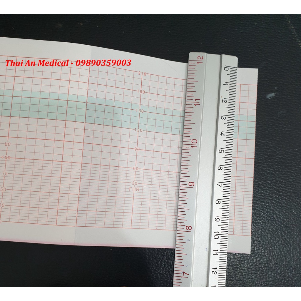 Giấy monitor sản khoa Goldway UT-3000A Edan MFM-800 sọc đỏ 112x100x150