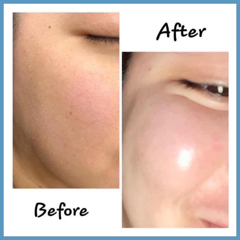 [SMAS] Serum HA Plus siêu cấp ẩm &amp; Pro Vitamin B5 phục hồi da