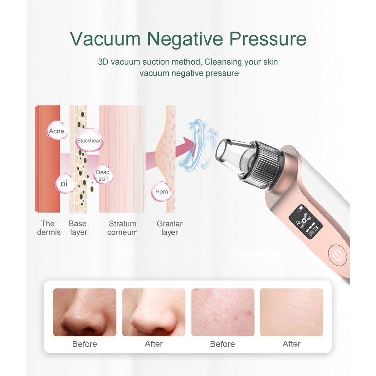 [Mã FMCGM50 - 8% đơn 250K] ANLAN Blackhead Vacuum Suction Deep Cleaner Beauty Tool