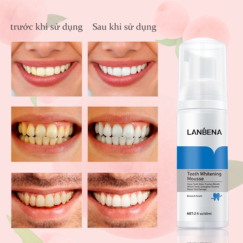Kem đánh răng mousse LANBENA phiên bản mới giúp làm trắng răng vệ sinh khoang miệng loại bỏ vết ố trên răng KB-LB-JY02