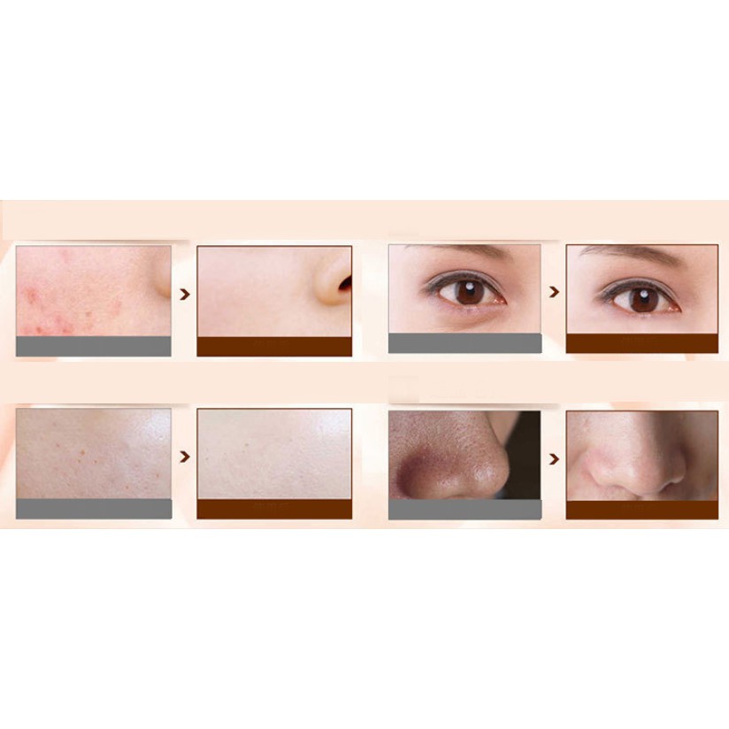 Kem Nền Trang Diểm dưỡng ẩm BB Cream Moisturing Lameila | BigBuy360 - bigbuy360.vn