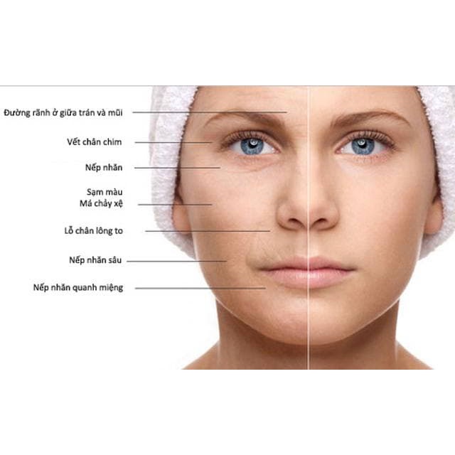 Kem dưỡng chống lão hóa, xóa nhăn, nâng cơ ANTI-AGING CREAM ZUZU