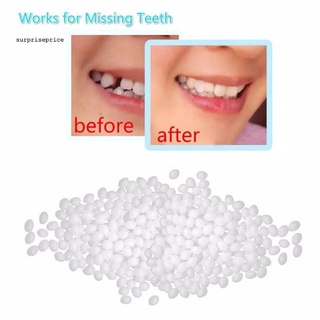 Keo Dán Răng Giả/Sơn Trơn 150 Tốc Độ
