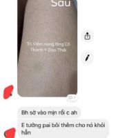 Viêm nang lông