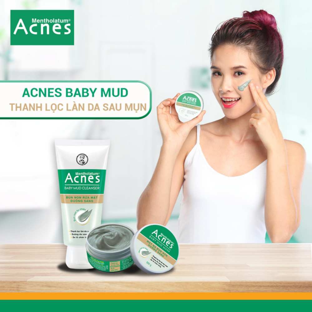 Acnes Baby Mud Mask - Mặt nạ bùn non dưỡng sáng 100g