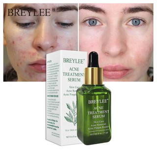 Serum Hỗ Trợ Giảm mụn BREYLEE 17ml