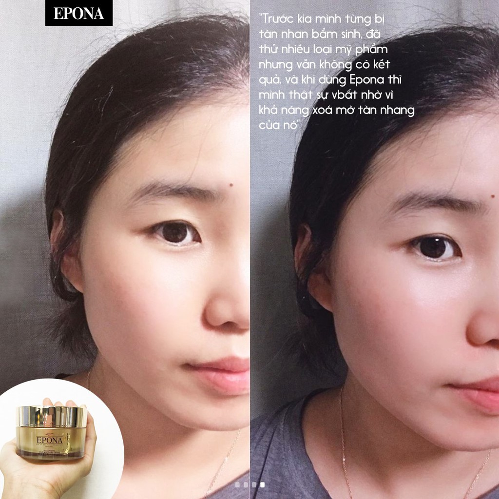 Kem dưỡng da Epona dầu ngựa dưỡng ẩm, chống lão hoá và Kem Epona hồng sâm giảm thâm nám từ 50ml _ Epona Chính Hãng