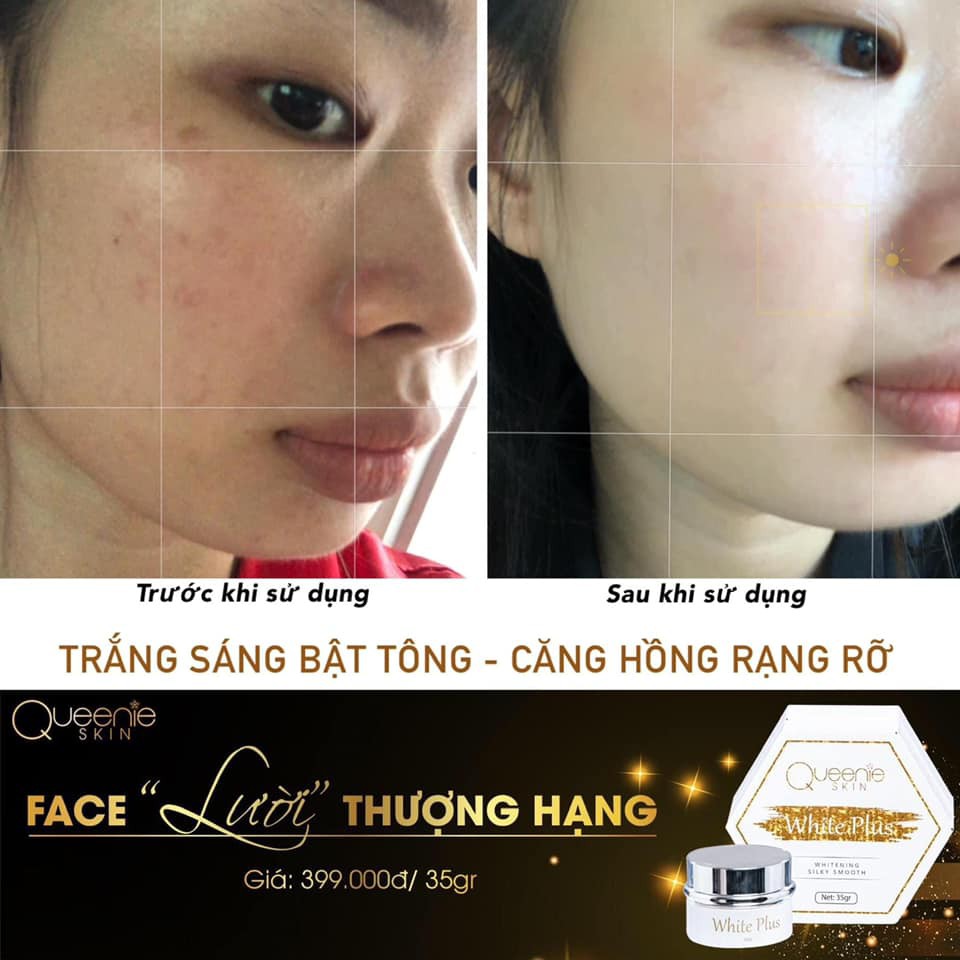 KEM FACE LƯỜI THƯỢNG HẠNG QUEENIE SKIN  Cấp Ẩm - Căng Mịn - Sáng Bóng Mới