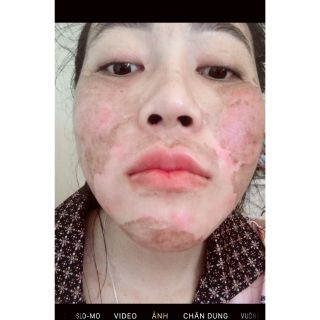 PEEL THAY DA MẶT TCA_USA