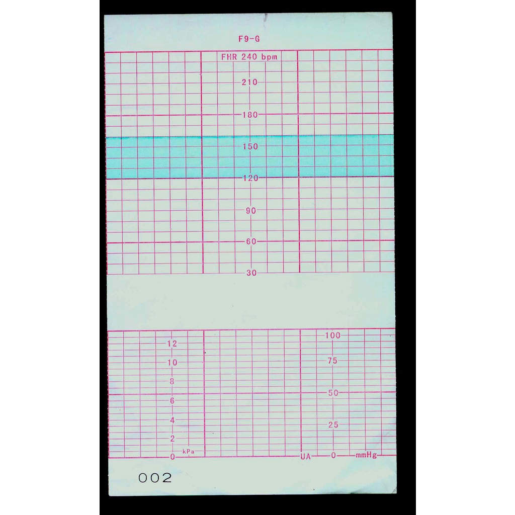 Giấy in monitor sản khoa ED15290P1 152MM X 90MM