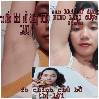 siêu dưỡng thâm 5s Biho ladi
