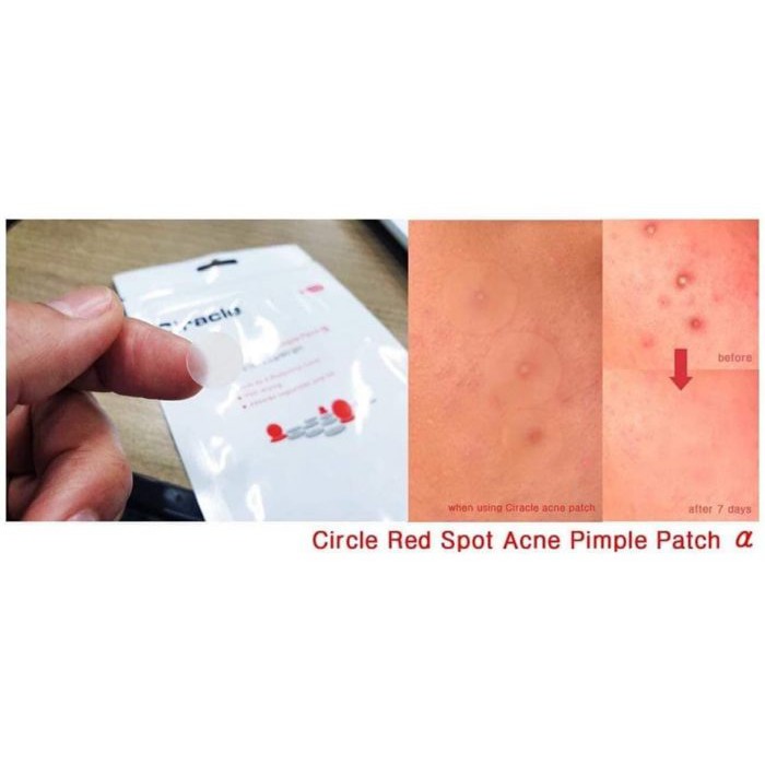 Miếng dán ngăn ngừa mụn Ciracle Red Spot Acne Pimple Path 24 Miếng