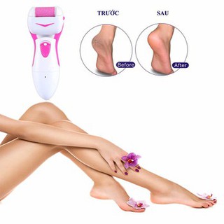 Máy Mài Gót Chân Shinon, Dụng cụ tẩy tế bào chết gót chân
