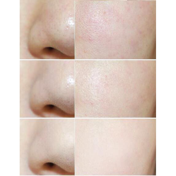 PHẤN PHỦ BABY SHISEIDO POWDER