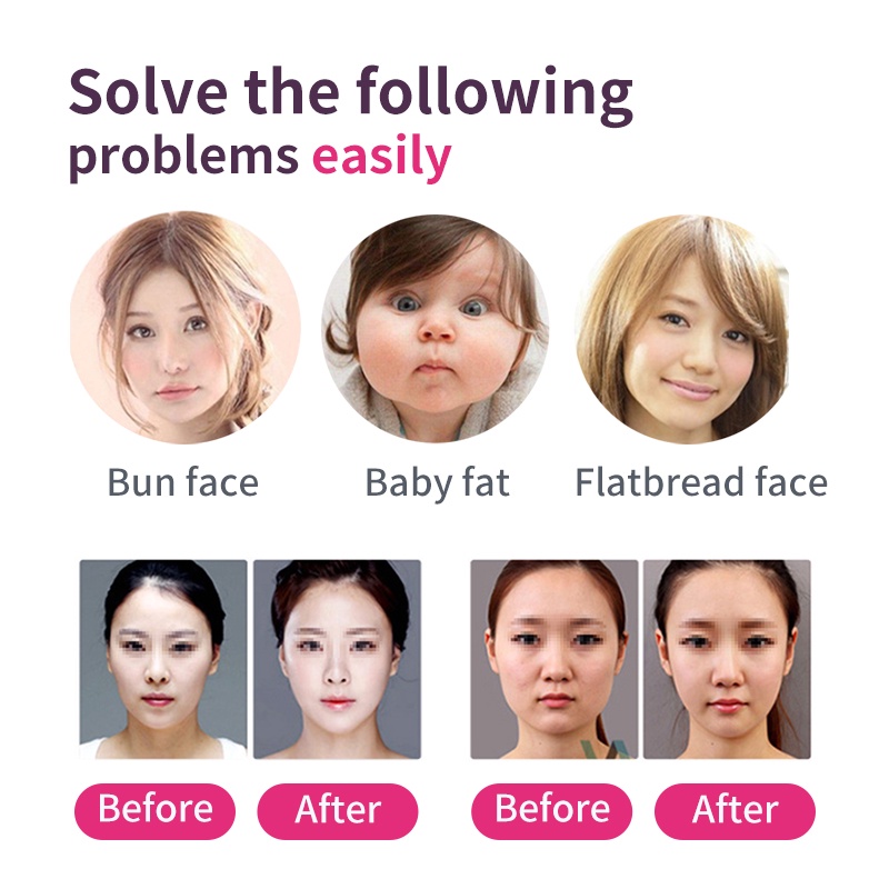 Băng đeo mặt JUNLAIKANG giảm béo tạo cằm V line mỏng bằng vải giặt được