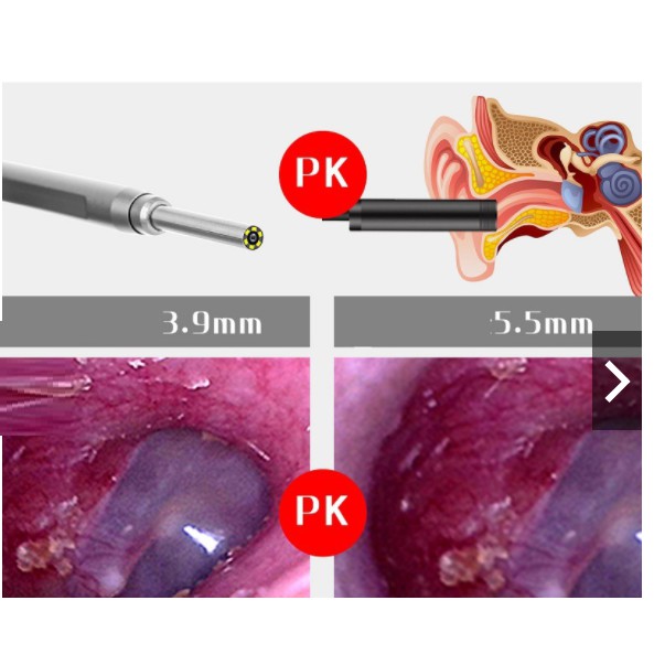 Dụng cụ soi tai cho trẻ em có camera nội soi độ nét cao 6 đèn led trợ sáng - Hàng loai 1