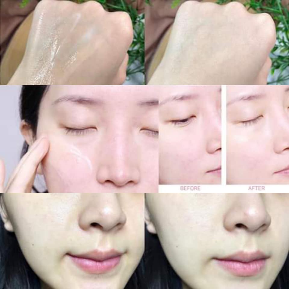 KEM DƯỠNG ốc sên Some by mi Snail Truecica Miracle Repair Cream 60g