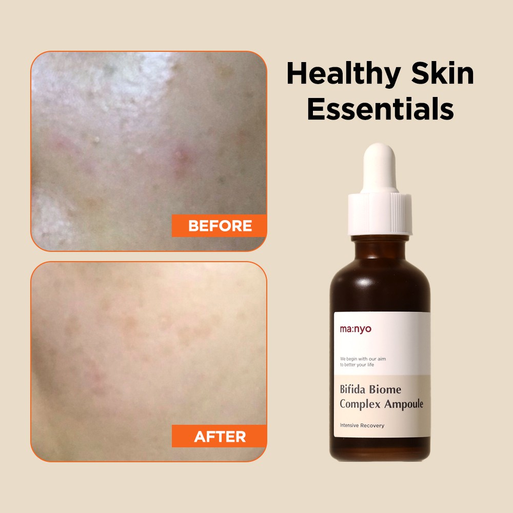 MANYO FACTORY Bifida Biome Complex Ampoule 50ml | BigBuy360 - bigbuy360.vn