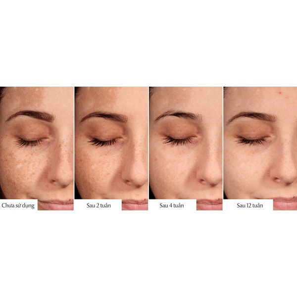 Bút Chấm Mờ Đốm Nâu, Nám, Tàn Nhang Eucerin UltraWhite+ Spotless Spot Corrector 5ml
