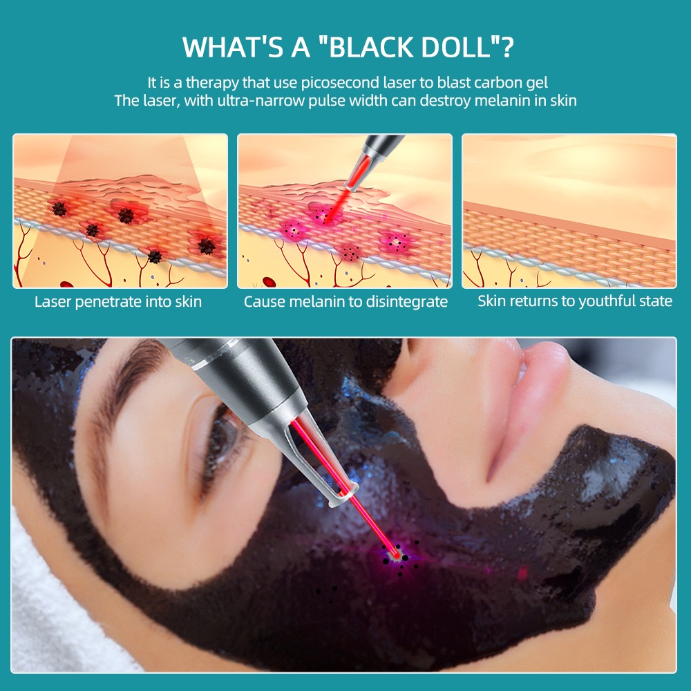 Gel carbon laser ForeverLily mềm mại làm trắng da chăm sóc da mặt