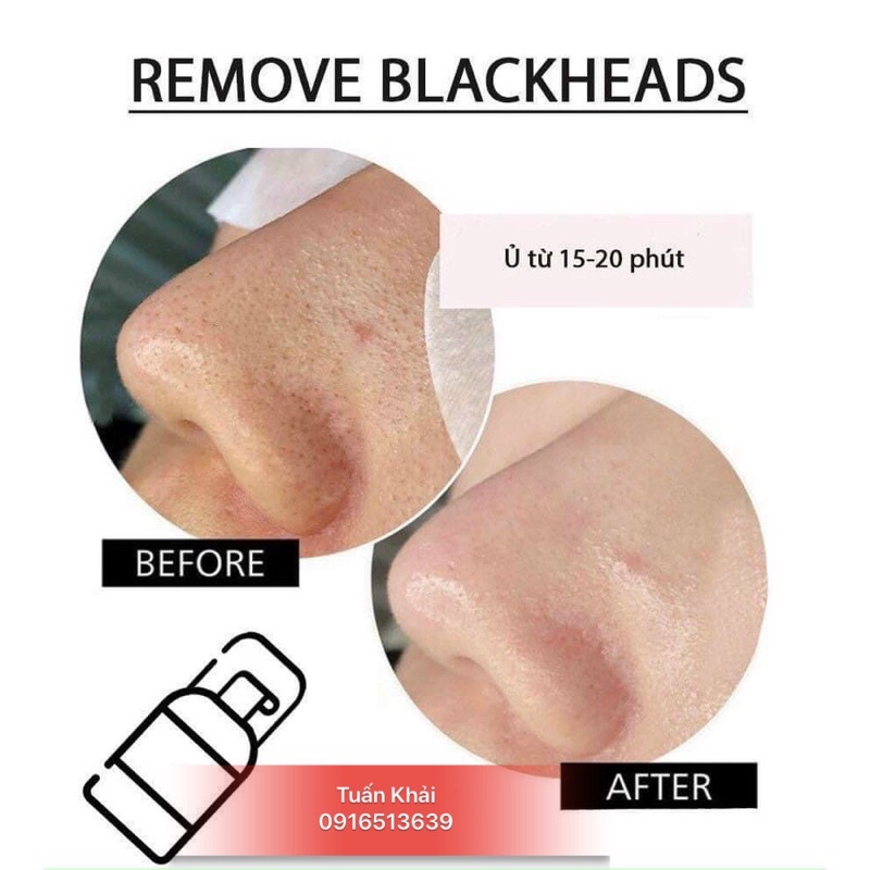 Ủ mụn đầu đen Remove BlackHeads ONMACABIM