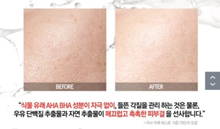 Sữa Rửa Mặt BadSkin Milk Bomb Eraser 100ML [MẪU MỚI]