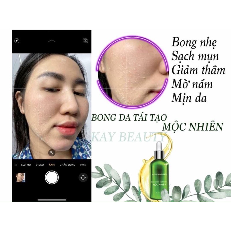 Tái tạo da mộc nhiên đông y (tặng 1 son nhung lì) | BigBuy360 - bigbuy360.vn