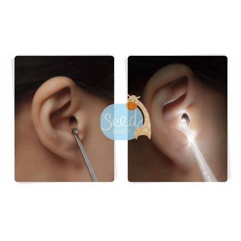 Dụng cụ lấy ráy tai có đèn Led