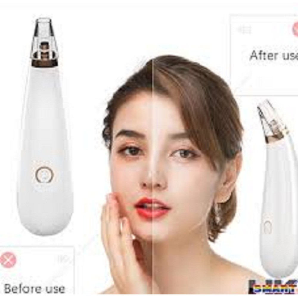 Máy hút mụn đầu đen