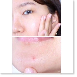 Tinh Chất Benton Snail Bee Ultimate Serum 35ml