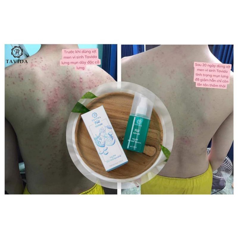 (KM MUA 2 TẶNG 1)Men vi sinh Tavida hết mụn viêm nang lông hiệu quả | Thế Giới Skin Care