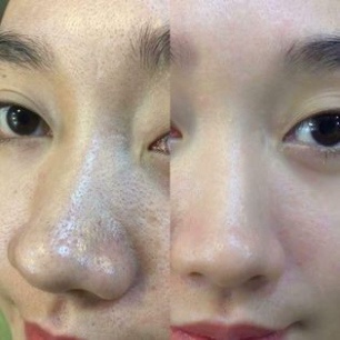 [CHÍNH HÃNG][MUA 2 TẶNG 1] Kem Ủ Trắng Thải Độc Chì Mờ Thâm Se Khít Lỗ Chân Lông Femmiu 30g Tặng Mặt Nạ | BigBuy360 - bigbuy360.vn