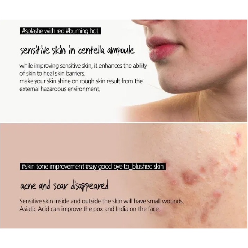 Tinh Chất Rau Má Madagascar Skin1004 Centella | BigBuy360 - bigbuy360.vn