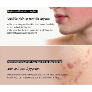 Tinh Chất Rau Má Madagascar Skin1004 Centella