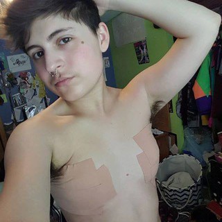 Keo vải dán ngực Tomboy