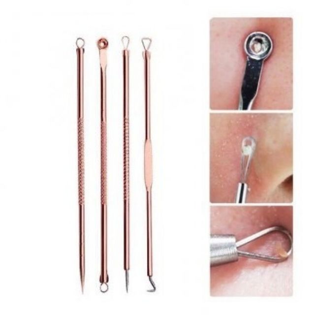 Bộ 4 cây nặn mụn kèm hộp đựng tiện dụng