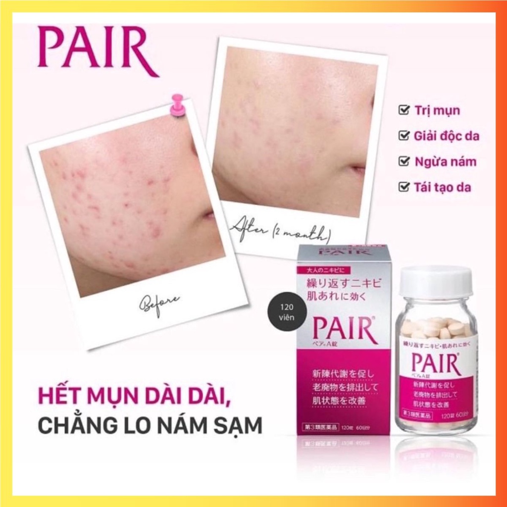 Viên uống Pair A giảm mụn bọc, mụn viêm, mụn trứng cá, mụn nội tiết Nhật Bản nội địa [Mô-Mô-Shop]