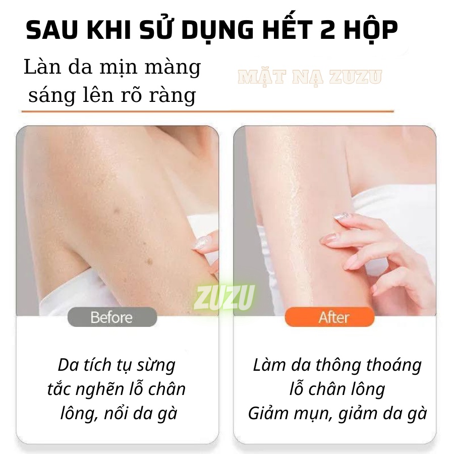 Tẩy Tế Bào Chết Body Mặt, Tẩy Da Chết Body Mặt Đào HONEY PEACH FENYI Tẩy Sạch Sâu và Trắng Da WINKBEAUTY