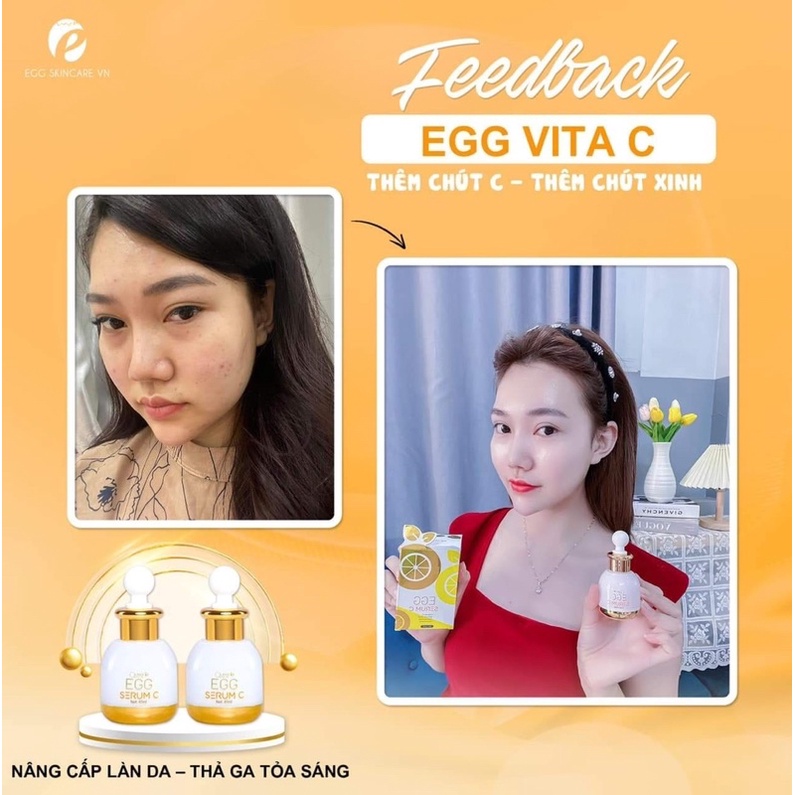 &lt; CHÍNH HÃNG GIÁ Sỉ&gt;  SERUM TINH CHẤT VITAMIN C làm trắng da căng sáng da Queenie Skin