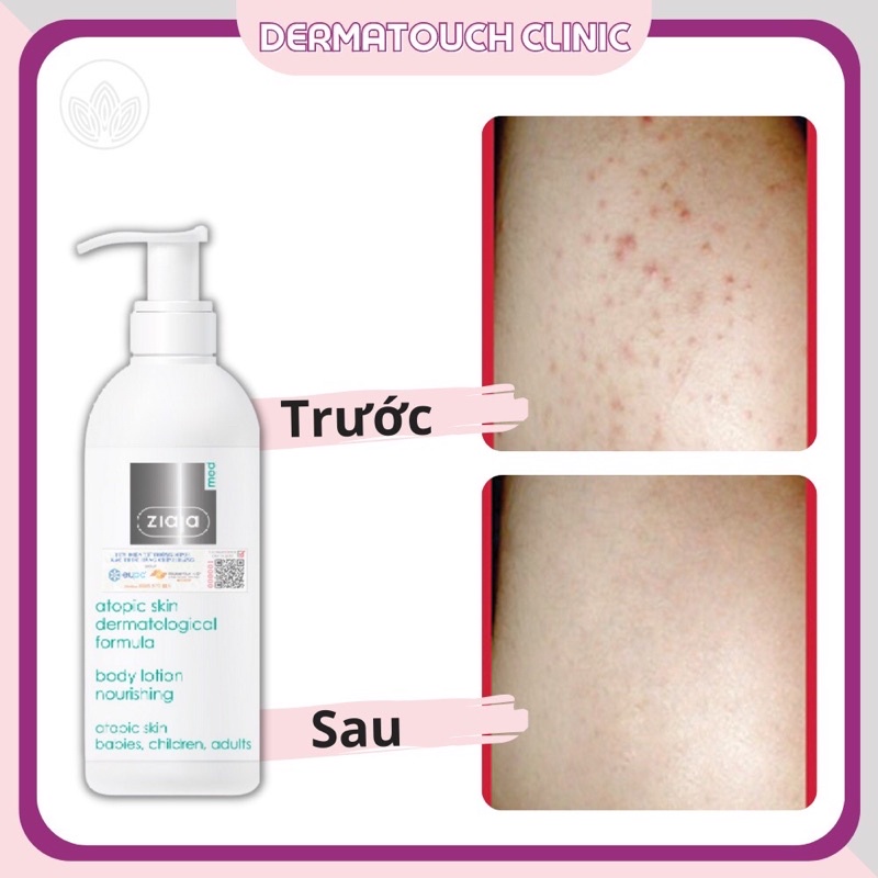Nhũ tương mượt da toàn thân Ziaja Med Atopic Skin 400ml