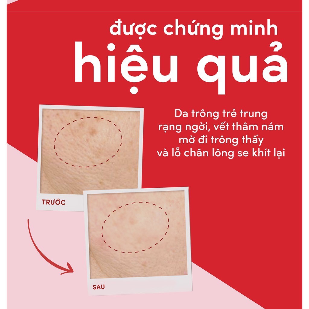 [Mã SR11JUNE5 giảm 20K đơn 50K] Kem chống lão hóa cao cấp Pond's Age Miracle ban ngày/đêm 50g