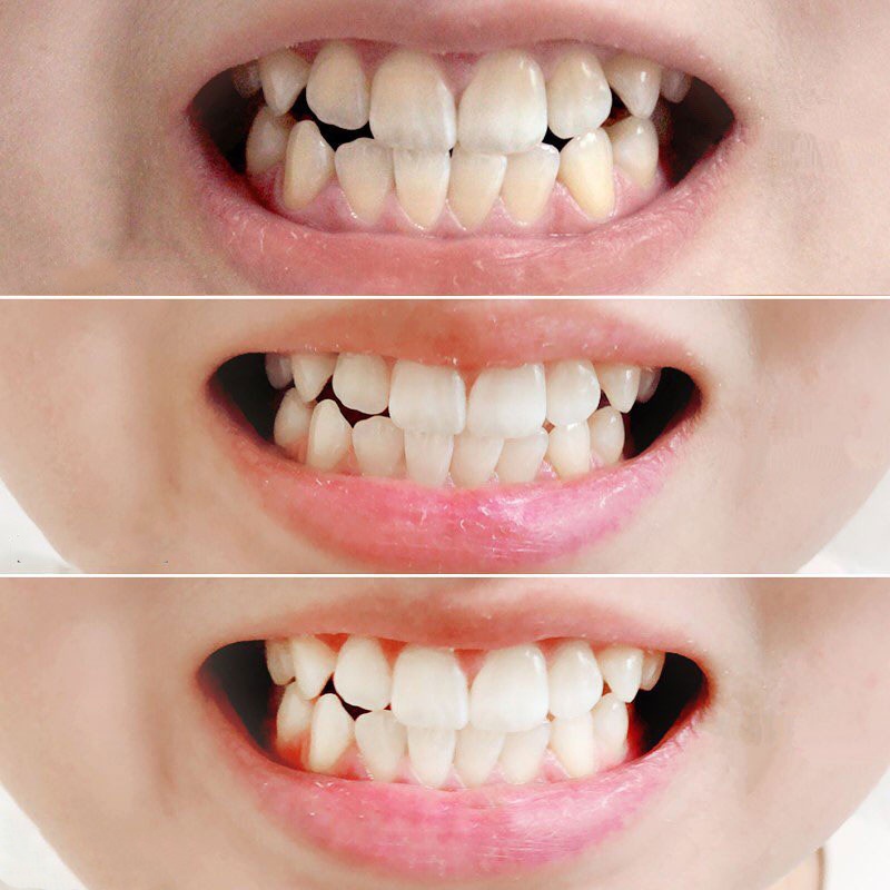 Kem Đánh Răng Median Dental IQ Toothpaste